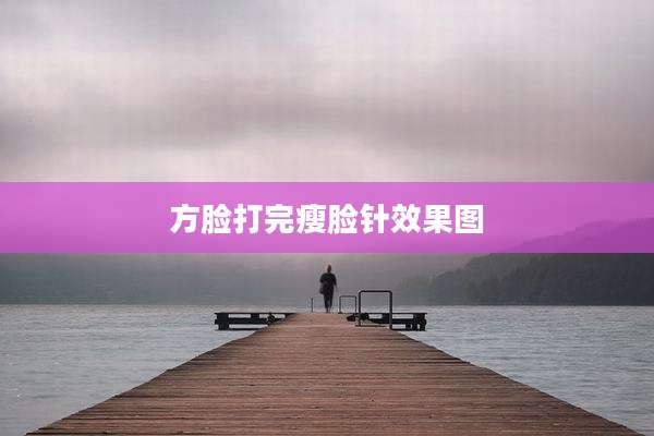 方脸打完瘦脸针效果图