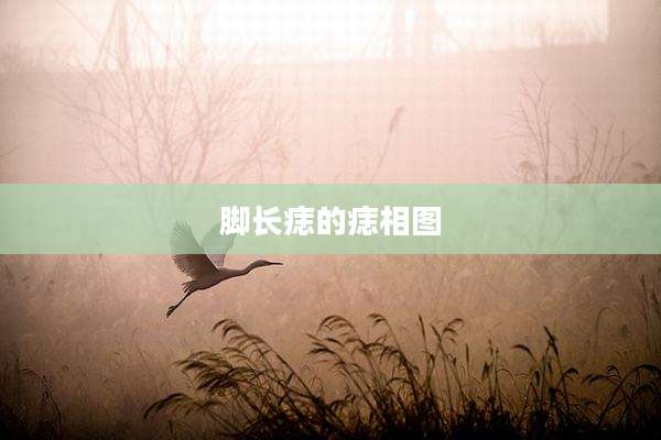 脚长痣的痣相图