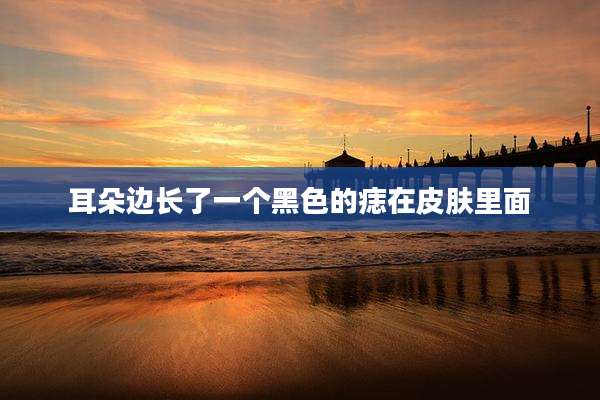 耳朵边长了一个黑色的痣在皮肤里面