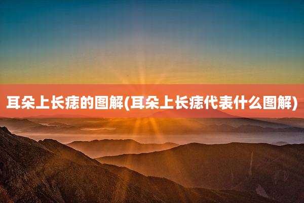 耳朵上长痣的图解(耳朵上长痣代表什么图解)